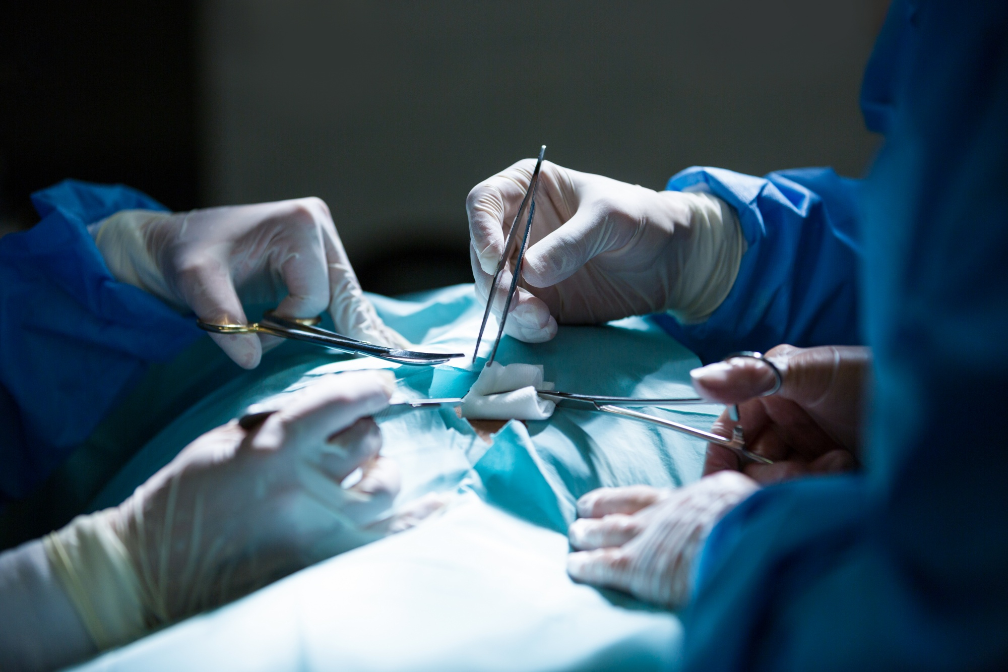 Umbilical Hernia Surgery in Peoria